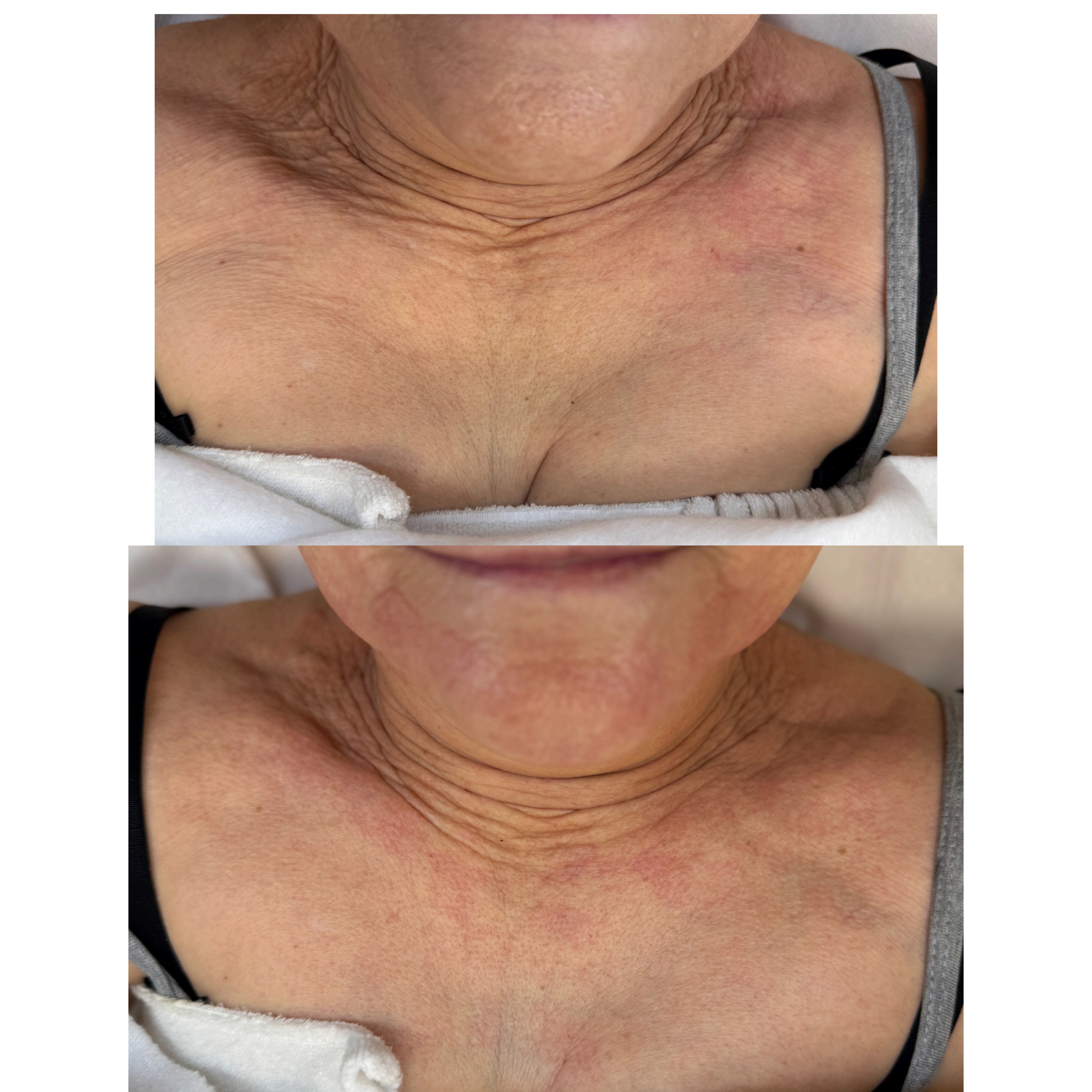 Efekt zabiegu kosmetologicznego - SkinLab Bydgoszcz